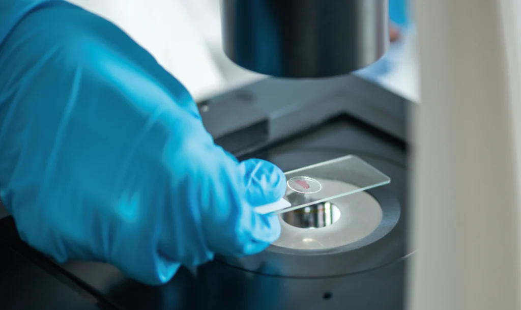Informe de resultados de un test epigenético, ideal para la prevención de enfermedades.