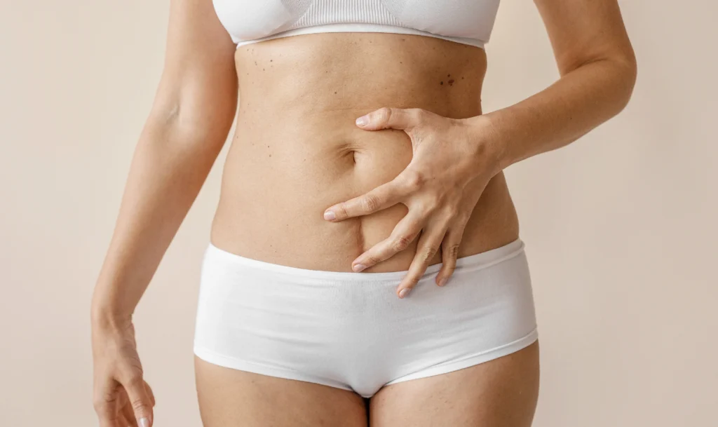 Láser T-Runner Fotona, tecnología avanzada para reafirmar el abdomen y combatir la flacidez abdominal.
