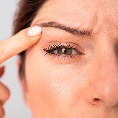 Tratamiento para bolsas en los ojos y párpados caídos en Clínica Lorents, Murcia