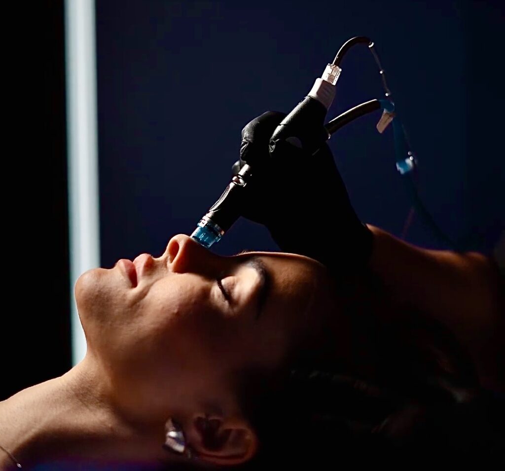 Aplicación de aparatología Hydrafacial para limpieza facial profunda en paciente de Clínica Lorents en Murcia