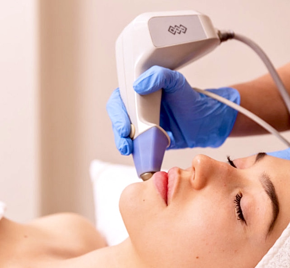 Aplicación de radiofrecuencia Exilis Ultra en el contorno mandibular para tensar la piel en Clínica Lorents Murcia